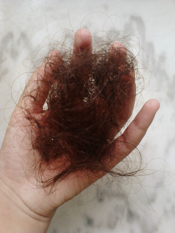 女性被脱发所扰，有哪些